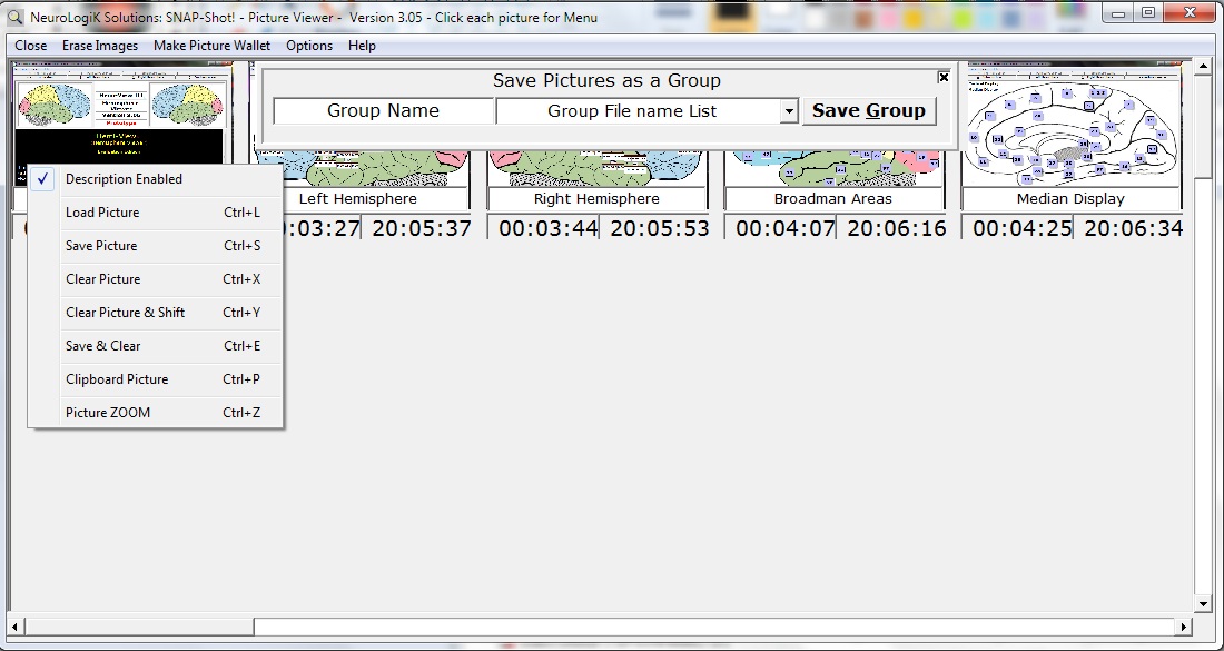 Neuro Picture Software Screens